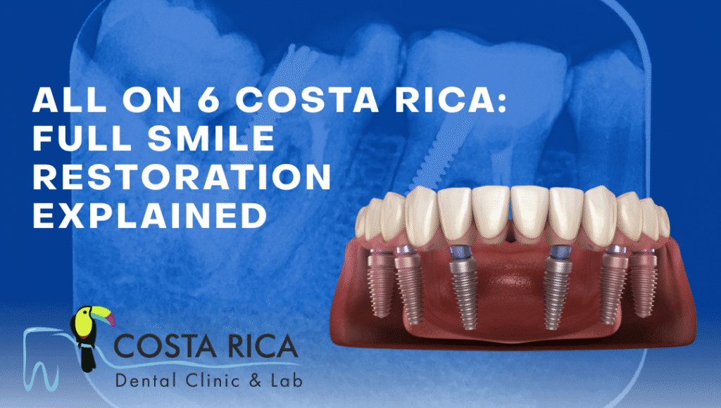 All on 6 Costa Rica: Full Smile Restoration Explained 2025 All on 6 Costa Rica Full Smile Restoration Explained