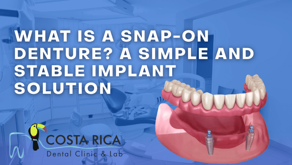 What Is a Snap-On Denture A Simple and Stable Implant Solution