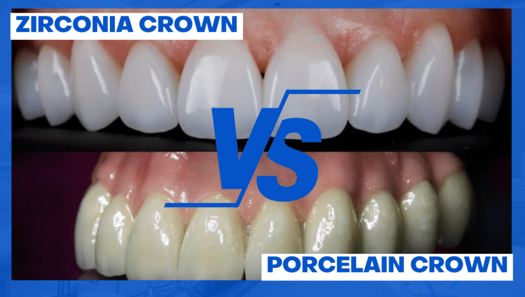 Zirconia vs Porcelain: Which Dental Crown Is Best for Dental Tourists? Zirconia vs Porcelain: Which Dental Crown Is Best for Dental Tourists?