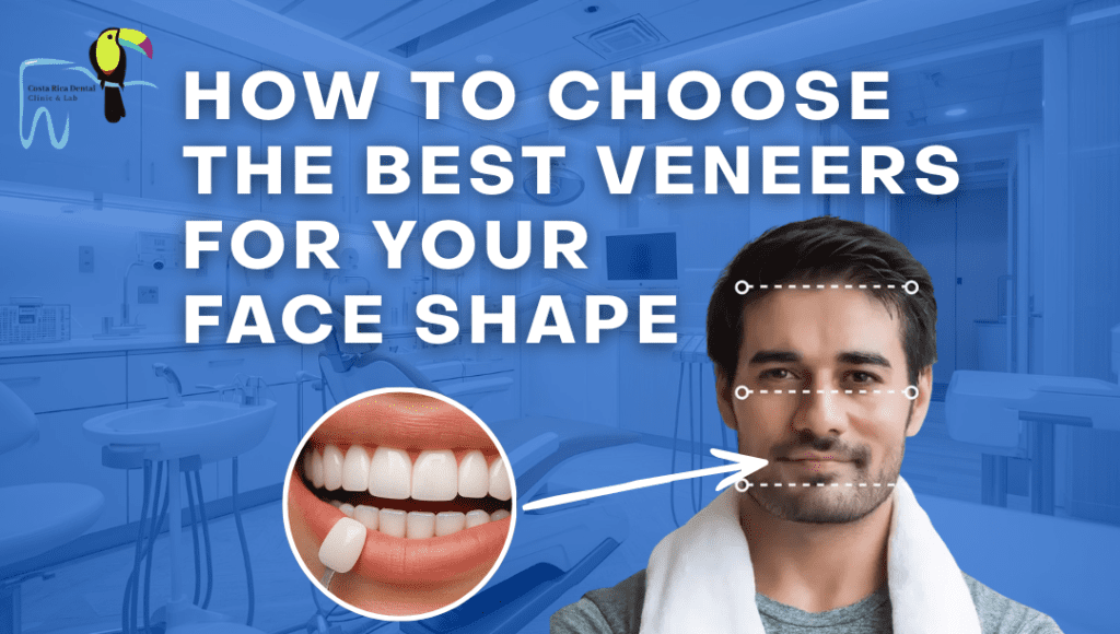 How to Choose the Best Veneers for Your Face Shape? How to Choose the Best Veneers for Your Face Shape?