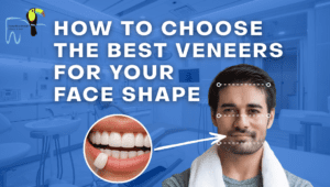 How to Choose the Best Veneers for Your Face Shape?