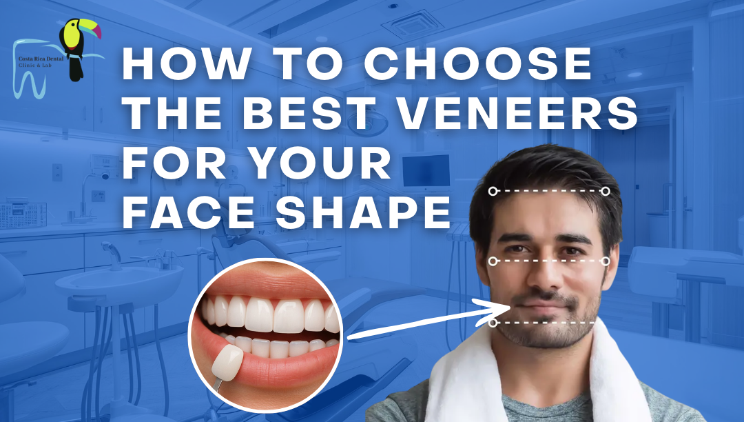 How to Choose the Best Veneers for Your Face Shape?