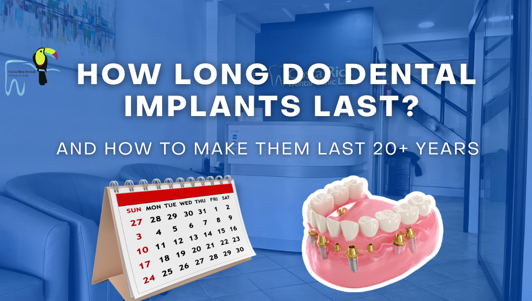 How Long Do Dental Implants Last?
