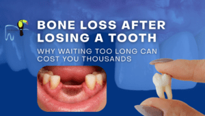 bone loss after losing a tooth