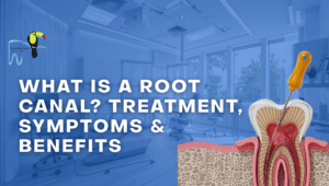 What Is a Root Canal? Treatment, Symptoms & Benefits