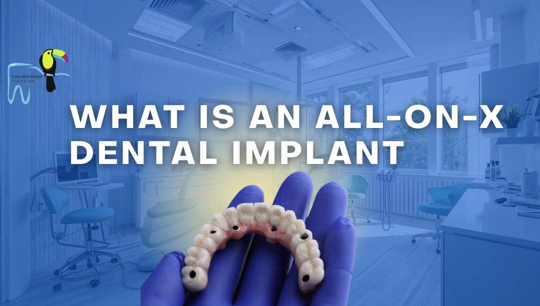 What Is an All-on-X Dental Implant? Complete Guide